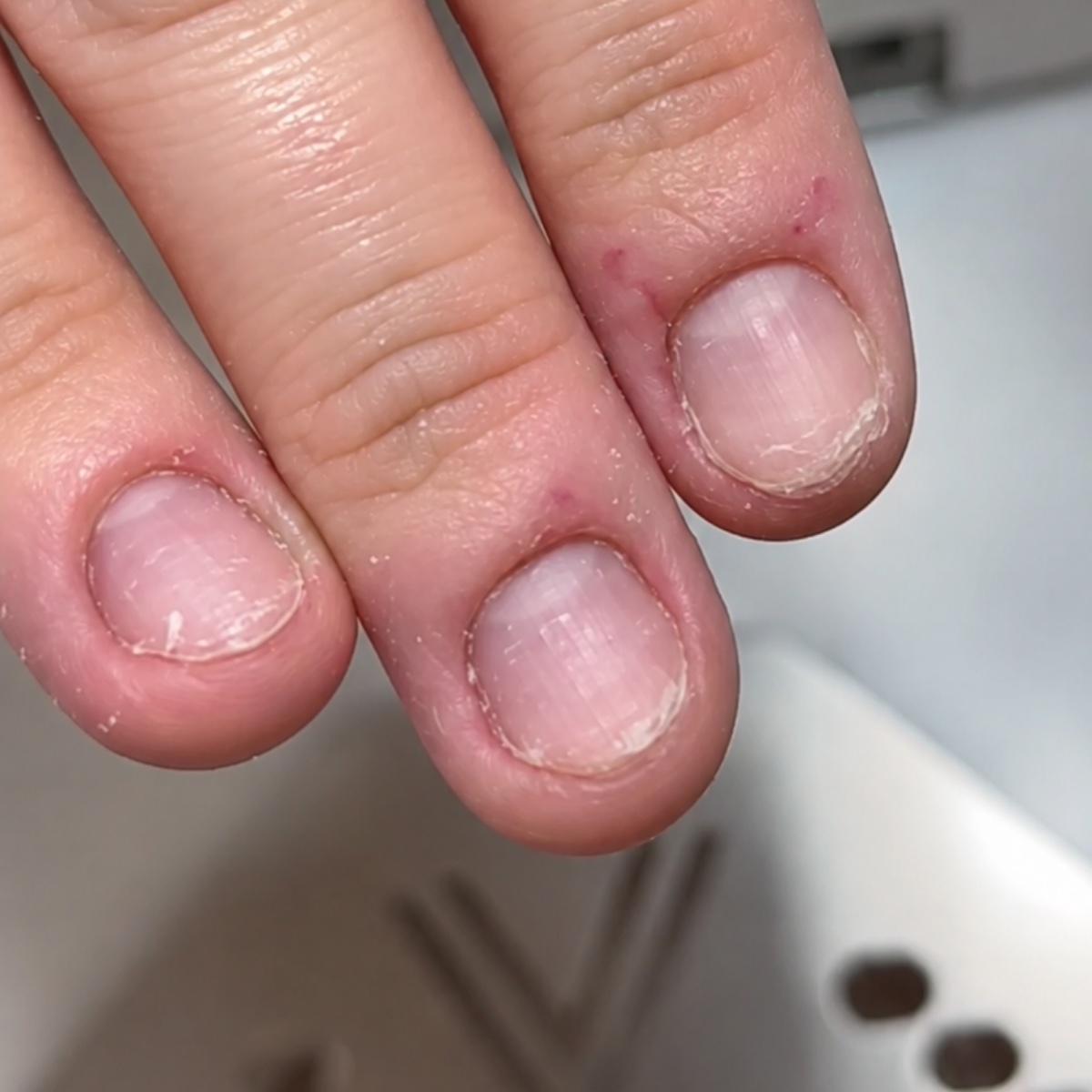 Bitten, uneven nails before an e-file correction