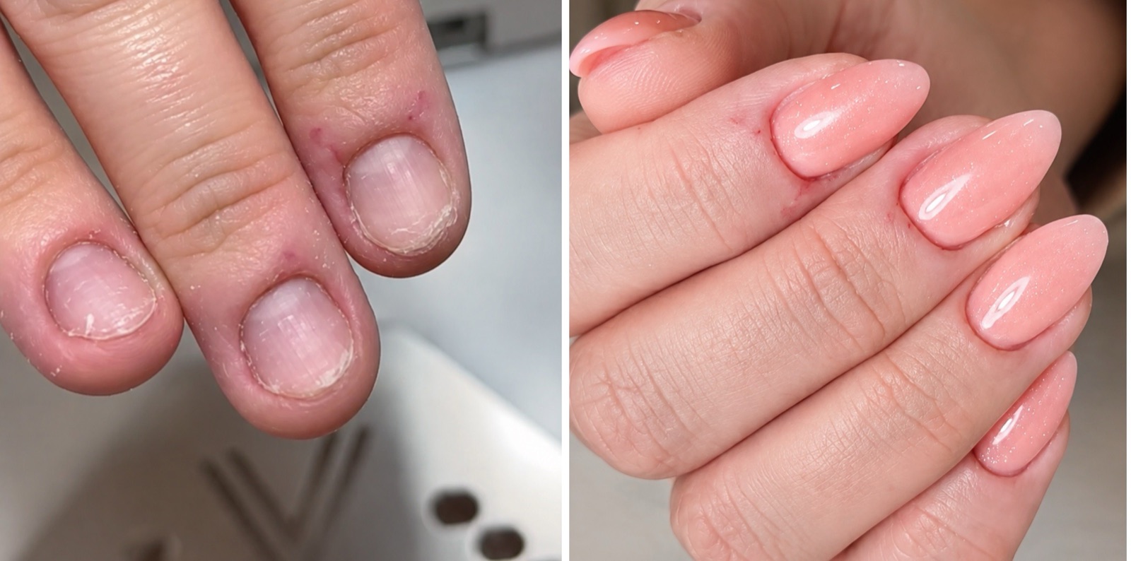 Nails before and after an e-file correction