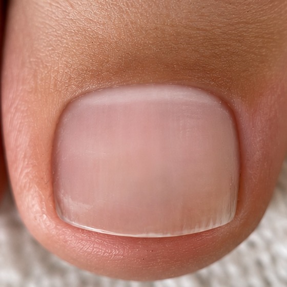 Toenail after a KOVA pedicure